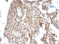  p53 Tumor Suppressor Protein Antibody - With BSA and Azide